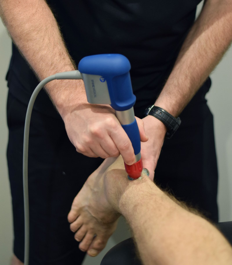 Shockwave Therapy - Achilles treatment